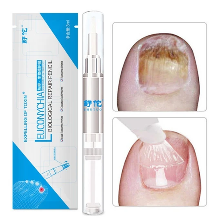 Remove-Fungus®- Caneta Removedora de Fungo de Unha